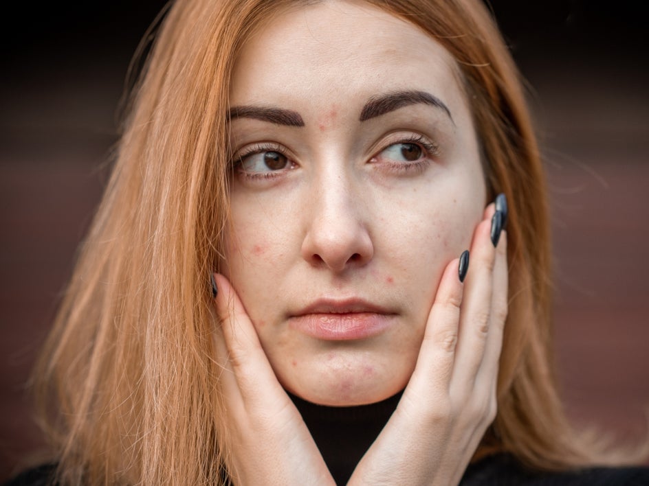 Before: Close up portrait with dull skin, blemishes, and poor lighting.
