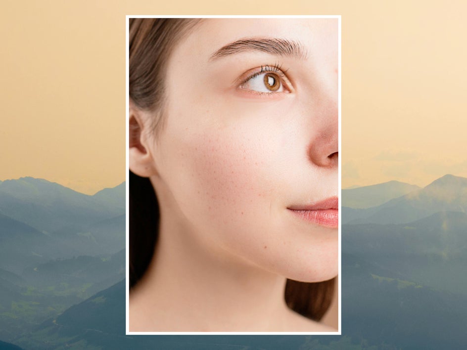 After: Same selfie with blemishes removed, skin texture preserved naturally.